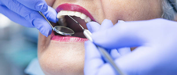 Best Emergency Dental Care for Broken or Chipped Teeth in Bohemia, NY